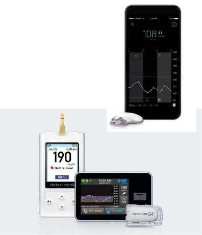 リアルタイムContinuous Glucose Monitoring(CGM)

ガーディアン（メドトロニック社）、Dexcom G4（テルモ社）　写真