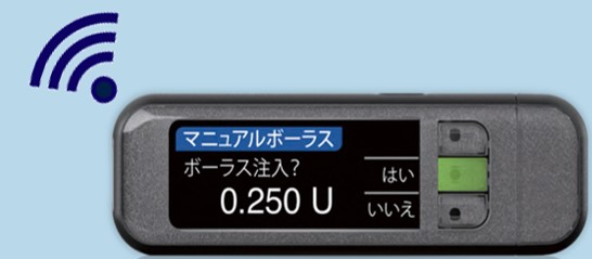 インスリンポンプ比較 パッチ式ポンプ メディセーフウィズ かミニメド640gか Mossanの糖尿病ガジガジ日記