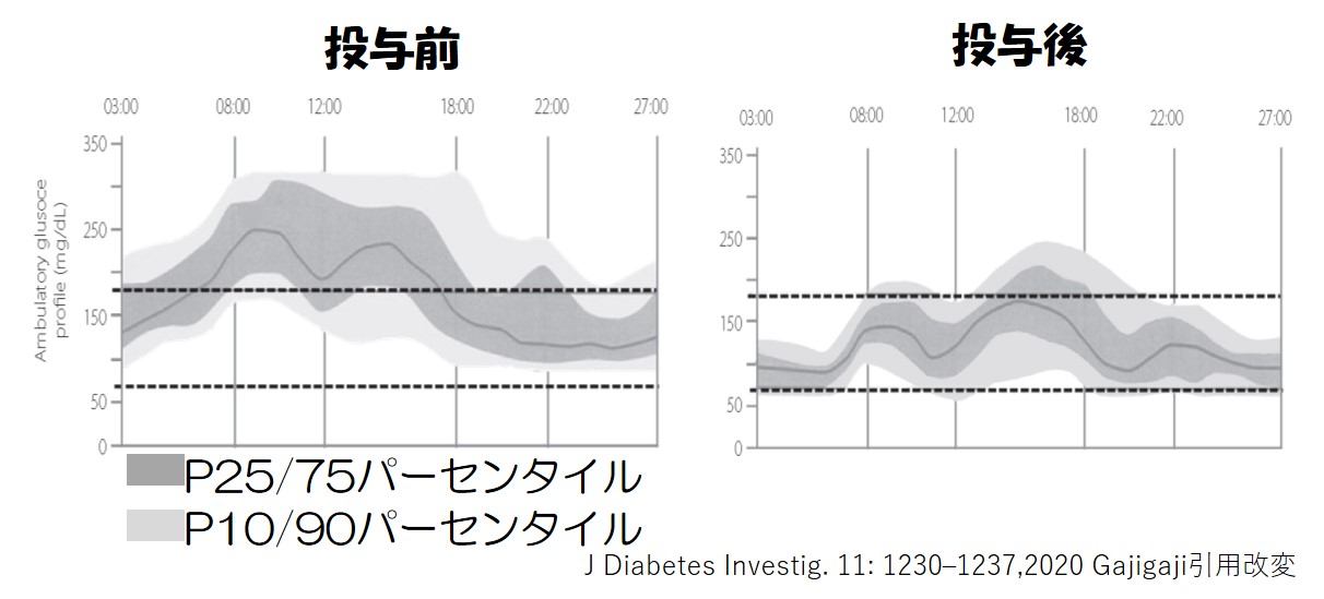 1型糖尿病患者にsglt2阻害薬を投与すると血糖変動が改善する Mossanの糖尿病ガジガジ日記