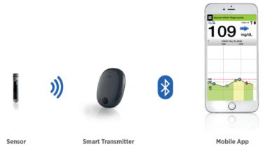 皮下埋め込み型持続血糖モニター（CGM)：Eversense® CGM System
